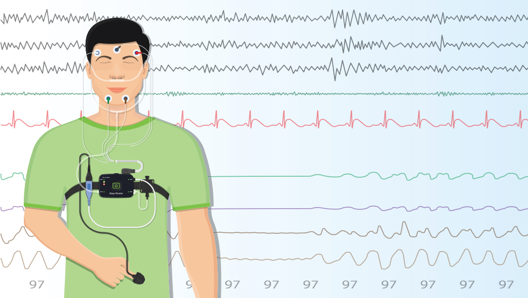 Featured Article Image: Learn about Sleep Labs and Sleep Study Centers